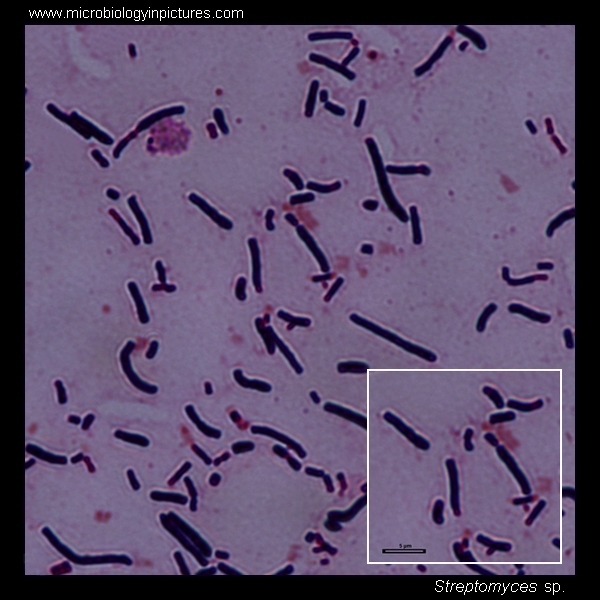 Streptomyces species